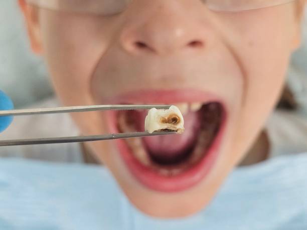 Best Weekend Emergency Dentist in Happy Valley, CA